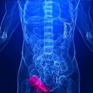 Κηλεπίδεσμοι